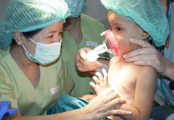 Everything you need to know about cleft lip and palate surgery Everything you need to know about cleft lip and palate surgery