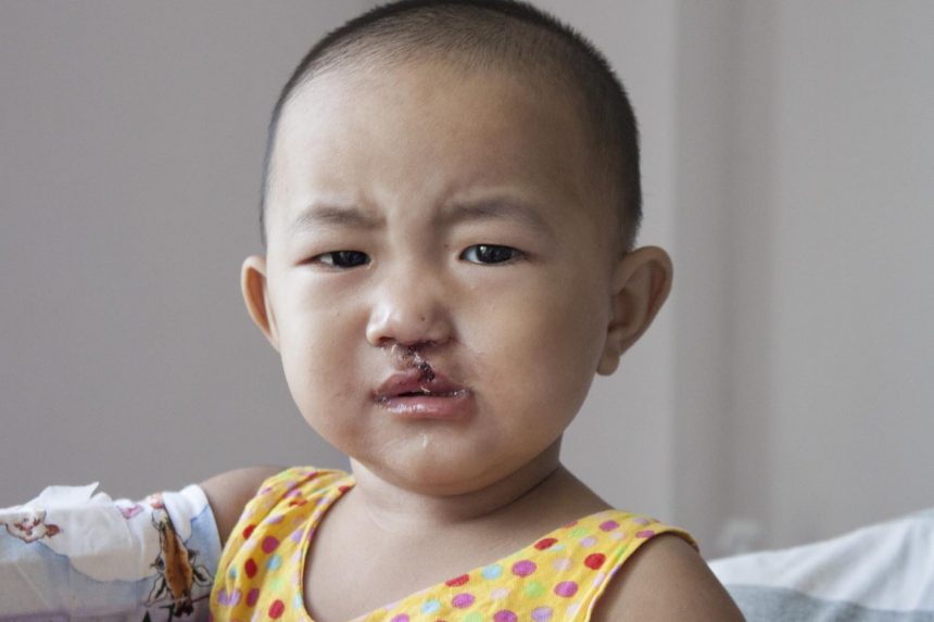 Day Five – Global Smile Day! Day Five – Global Smile Day!