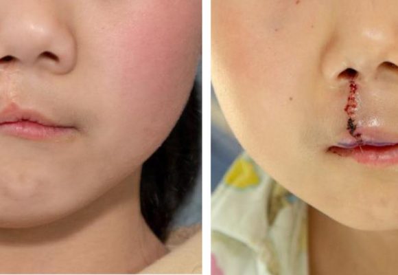 On the Surgery Ward – Chuzhou, China On the Surgery Ward – Chuzhou, China